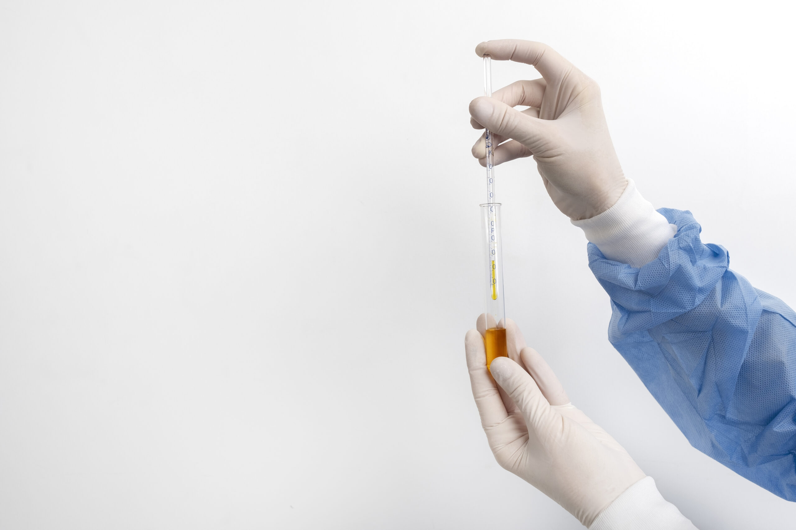 лаборант с пробиркой и пипеткой делает забор