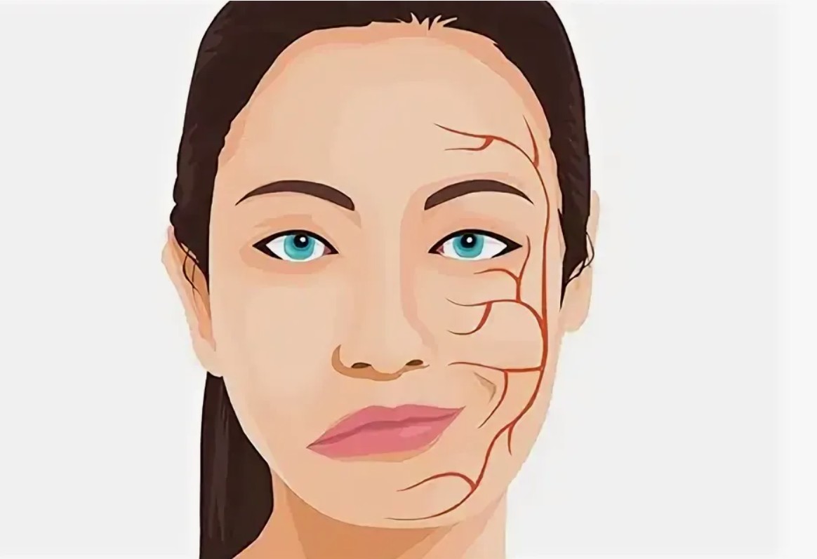 Гемифациальный спазм