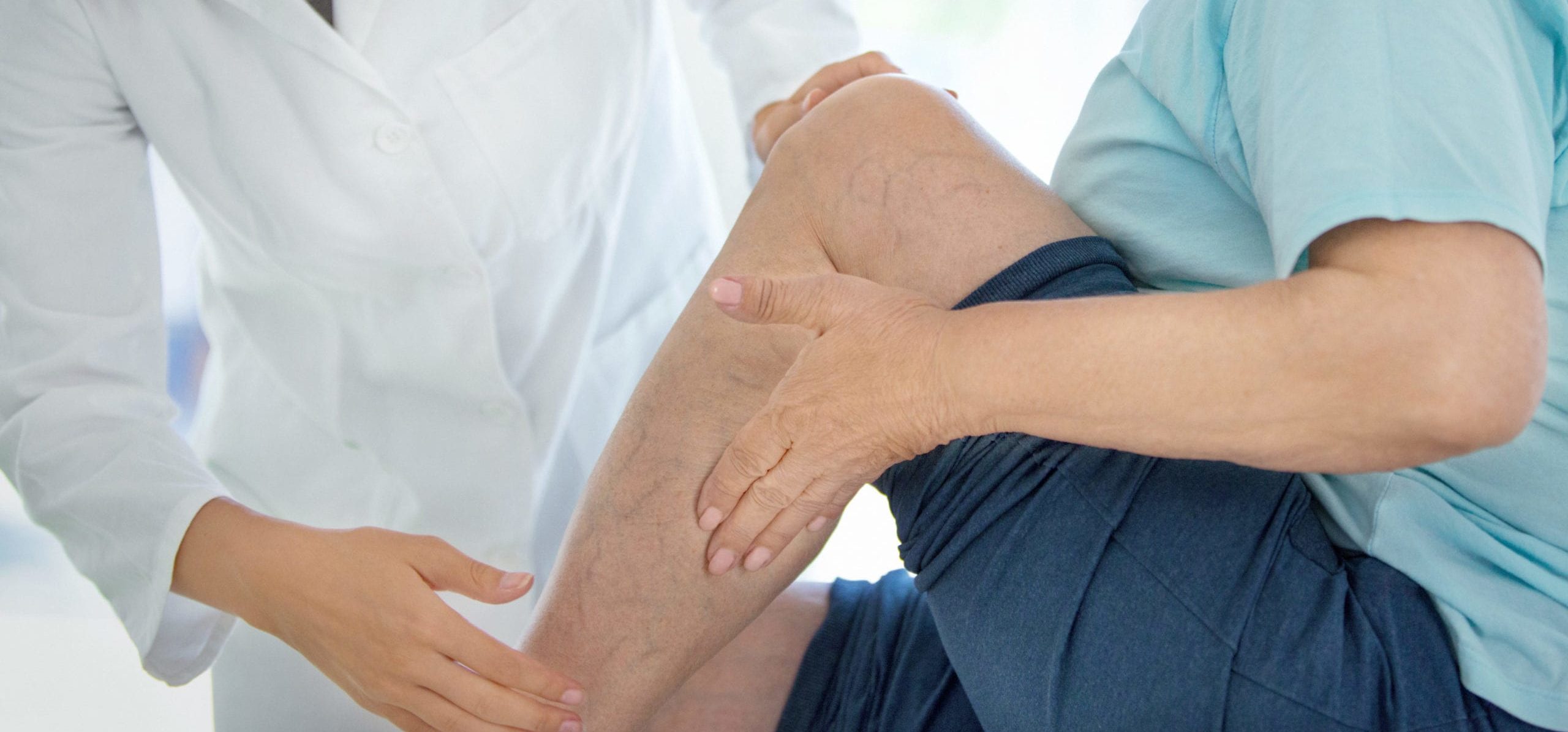 посттромбофлебитическая болезнь симптомы